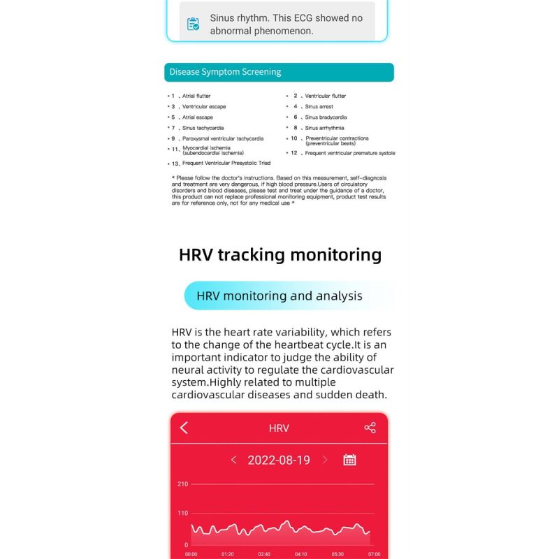 EP01 Blutzucker-Zucker-Smartwatch EKG  PPG HRV-Herzfrequenztemperatur 1,47 