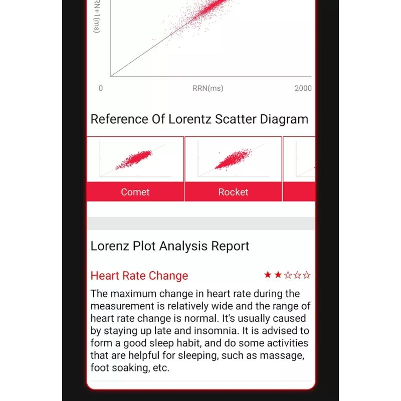 EP02 Blutzucker-Zucker-Smartwatch EKG  PPG HRV-Herzfrequenztemperatur 1,57 